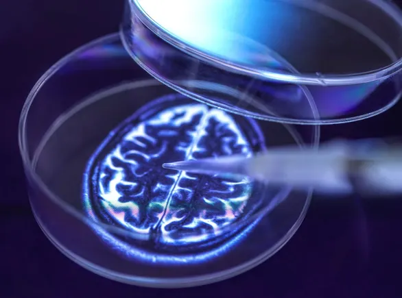 AC Immune posts positive data for Parkinson’s immunotherapy