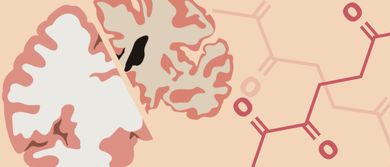 Naturally occurring metabolite may help fight Alzheimer’s