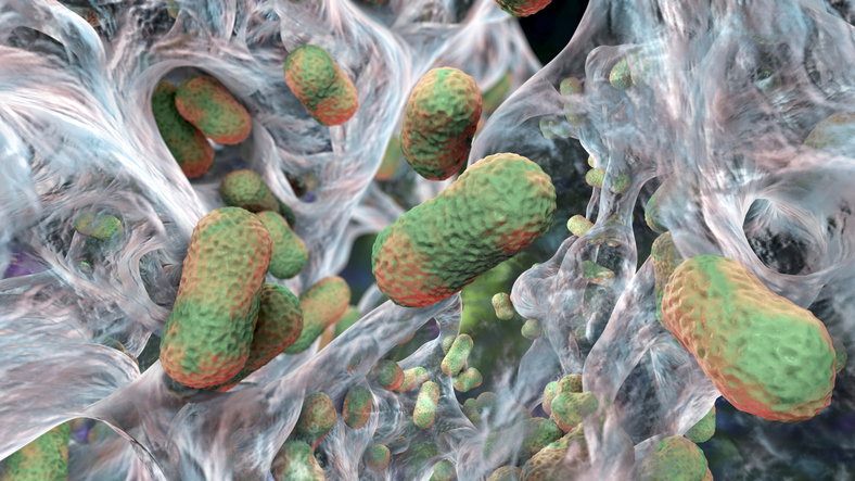 Bacterial Biofilms Unexpectedly Found Inside Most Common Kidney Stones