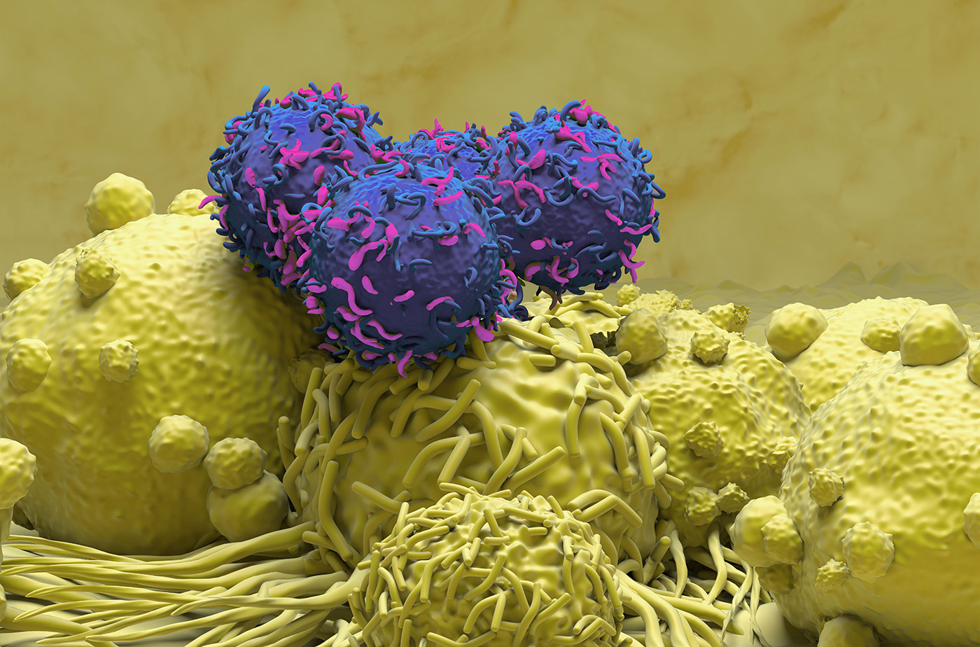 Macrophage-Targeting CAR T Cell Therapy Improves Survival in Solid Tumor Mouse Models