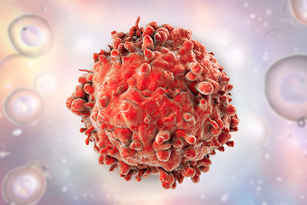 Rare Inherited Genetic Variant Protects Against Blood Cancer, Reduces Leukemia Risk