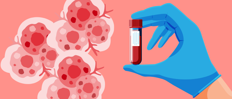 New liquid biopsy technology set to transform cancer diagnostics
