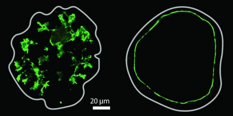 Organoids Reveal How Pressure and Growth Shape Pancreatic Lumens