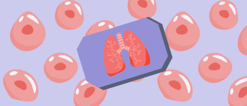 Single-donor “lung-on-chip” breathes new life into disease modeling and personalized medicine
