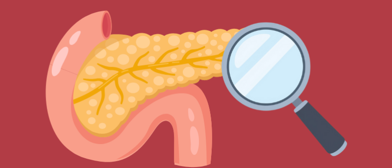 Engineering lumens in pancreatic organoids