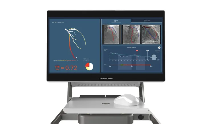 Medtronic to acquire CathWorks for up to $585M