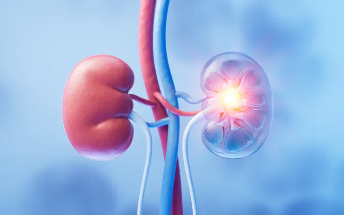 R1 starts up with $78M, aiming for a better kidney drug