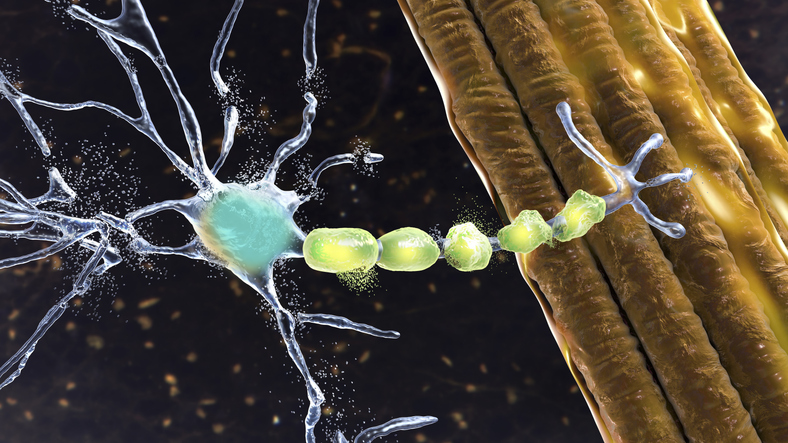 Biological Complexity of ALS to Be Addressed by the Development of New Stem Cell Models