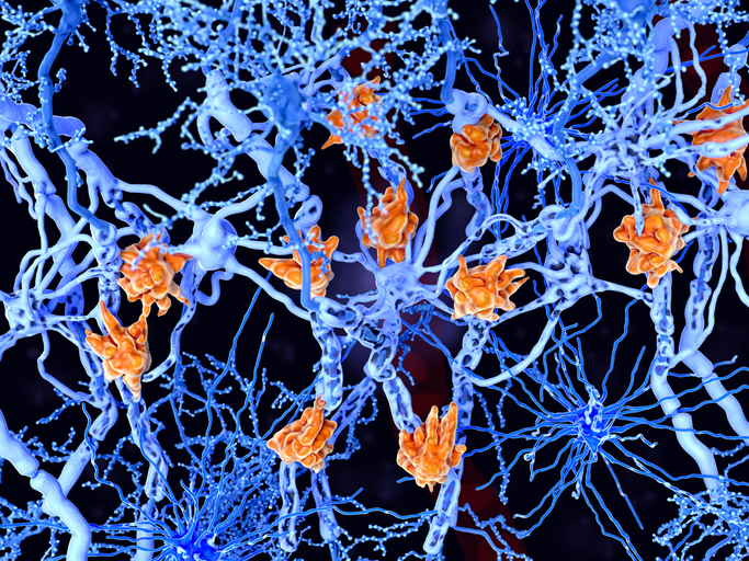 Multiple Sclerosis Myelin Loss Revealed by Transcriptomic Analysis in Mice