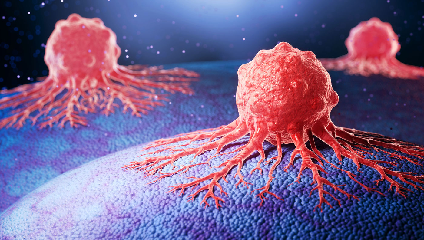 Enzymes Involved in Cholesterol Transport May Point to New Cancer Therapies